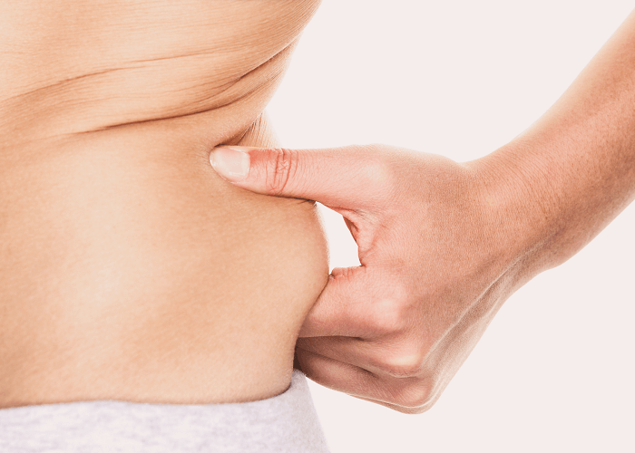 woman pinching fat